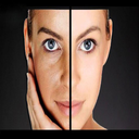 Skin rejuvenation