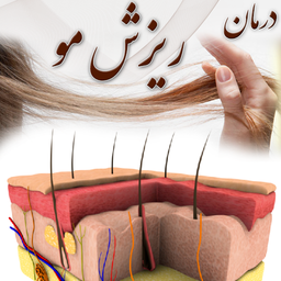 Hair Loss Treatment