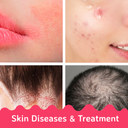 Skin Diseases and Treatments