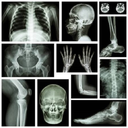 X RAY Interpretation - cases