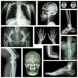 X RAY Interpretation - cases