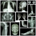 X-RAY Interpretation - cases