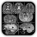 Imaging Brain, Skull & Cranioc