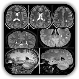 Imaging Brain, Skull & Cranioc