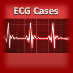 ECG Cases