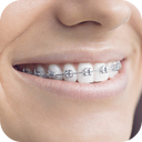 Teeth Braces Photo editor