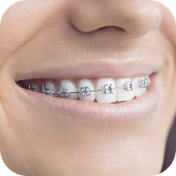 Teeth Braces Photo editor