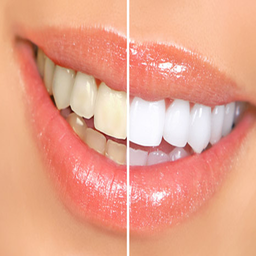 21 روش برای سفید کردن دندان