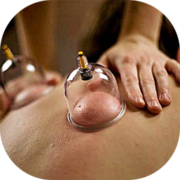 باید و نبایدهای حجامت