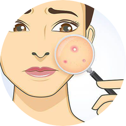 Secrets of Acne