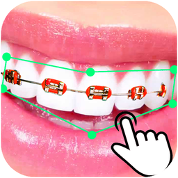 Braces Booth Stickers photo ed