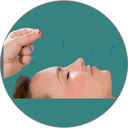 نکات طب سوزنی