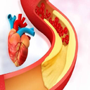 آموزشگاه _ درباره کلسترول و بیماری