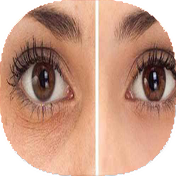 نکات درمانی گودی  چشم ها