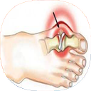 نکات درمانی آرتروز