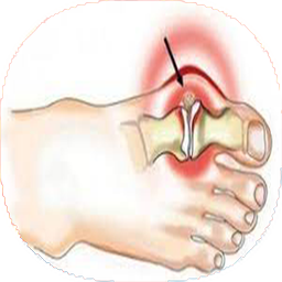 نکات درمانی آرتروز