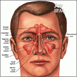 اختلالات سر و بینی
