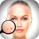 Face Enhancer: Blemish Remover