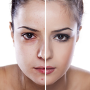 Before & After Video Maker