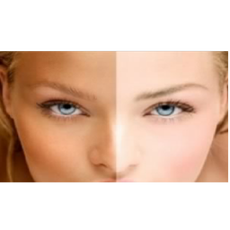 ترفند های سفید شدن پوست صورت