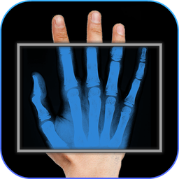 Xray scan filter camera
