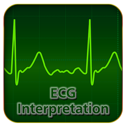 ECG Interpretation