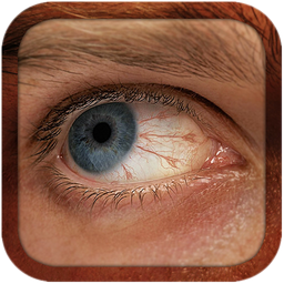 علم تشخیص بیماری از روی چشم