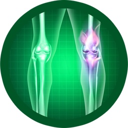 بیماری های استخوان و مفاصل