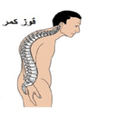 پیشگیری و درمان غوز کمر