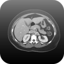 Radiology CT Viewer