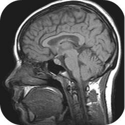 MRI Viewer