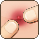 Pimple Popper