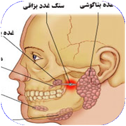 بیماری های غدد