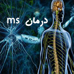 ms درمان