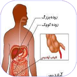 آپاندیس
