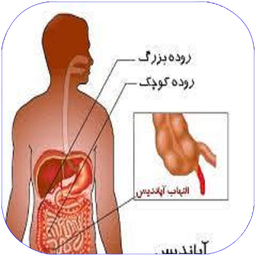 آپاندیس