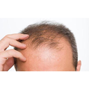 درمان تضمینی ریزش مو (100%)