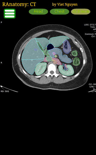 Radiology CT Anatomy - Image screenshot of android app