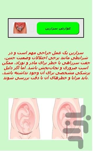مزایای زایمان طبیعی - عکس برنامه موبایلی اندروید