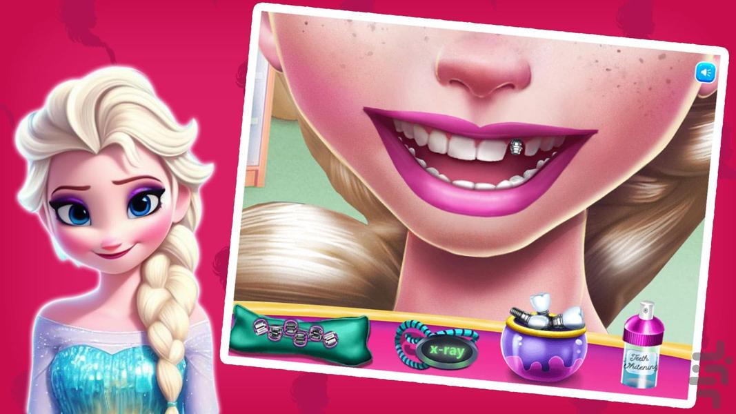 Elsa mouth doctor game - Gameplay image of android game