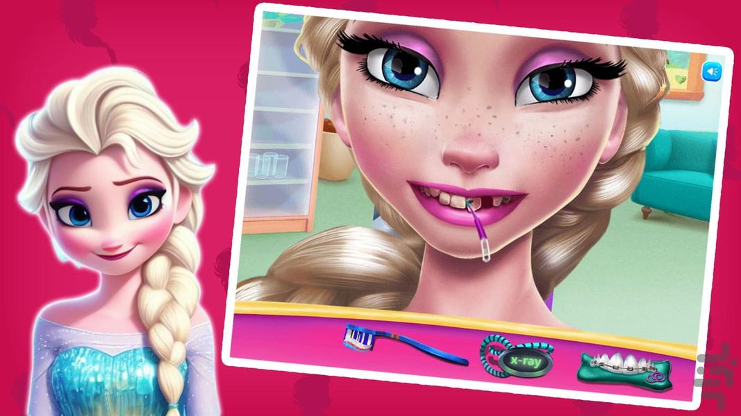 Elsa mouth doctor game - Gameplay image of android game