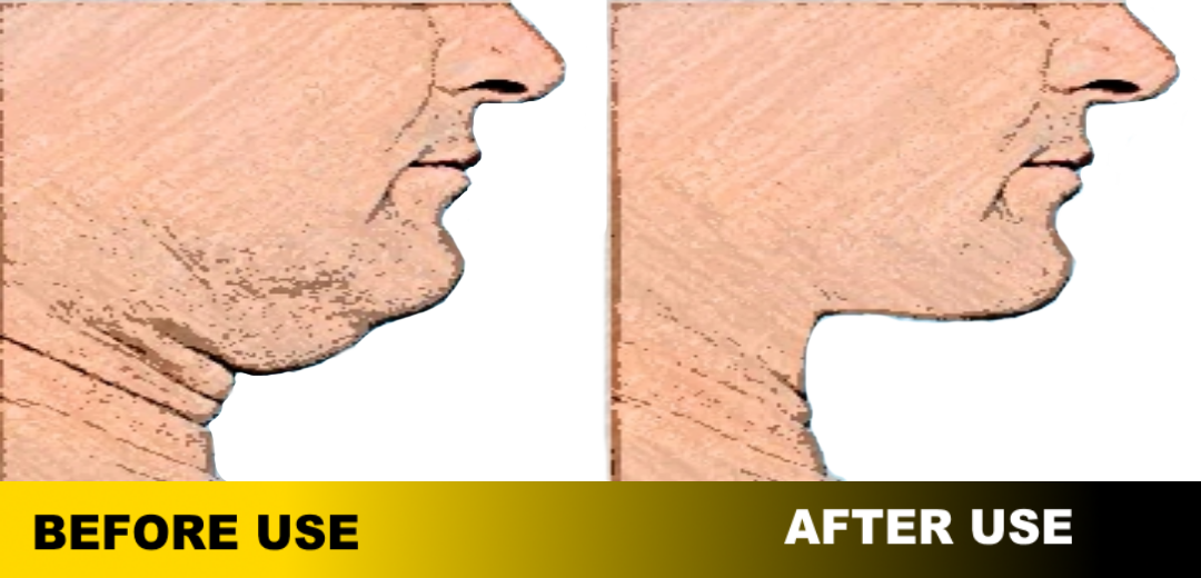 Jaw Muscles Exercises - Redefi - Image screenshot of android app