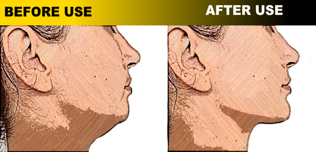 Jaw Muscles Exercises - Redefi - Image screenshot of android app