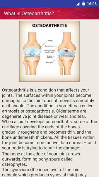 Joint Pain Osteoarthritis Help - عکس برنامه موبایلی اندروید