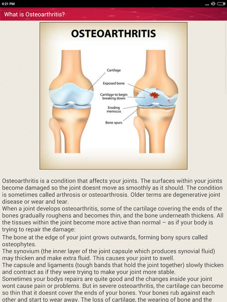 Joint Pain Osteoarthritis Help - عکس برنامه موبایلی اندروید