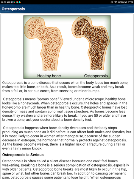Osteoporosis Weak Bones Diet - Image screenshot of android app