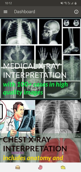 X-RAY Interpretation - cases - Image screenshot of android app
