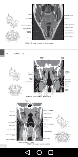 CT Scan Cross Sectional Anatomy for Imaging Pros - عکس برنامه موبایلی اندروید
