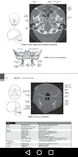 CT Scan Cross Sectional Anatomy for Imaging Pros - عکس برنامه موبایلی اندروید
