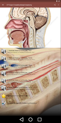 CT Scan Cross Sectional Anatomy for Imaging Pros - عکس برنامه موبایلی اندروید